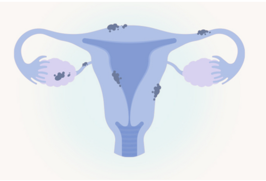 Endometriosis Awareness Month: Gut Health & Endo