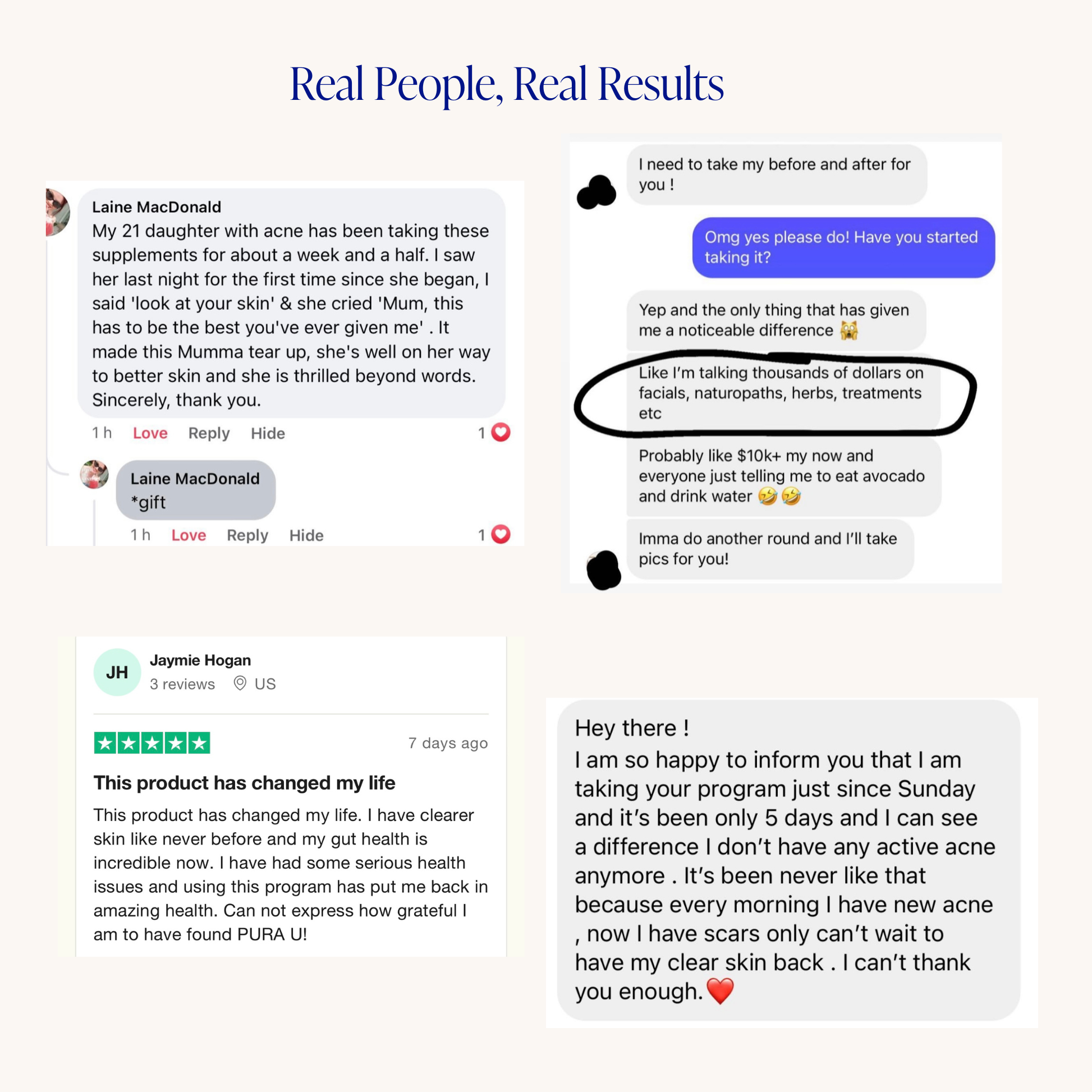 中級ニキビプログラム™