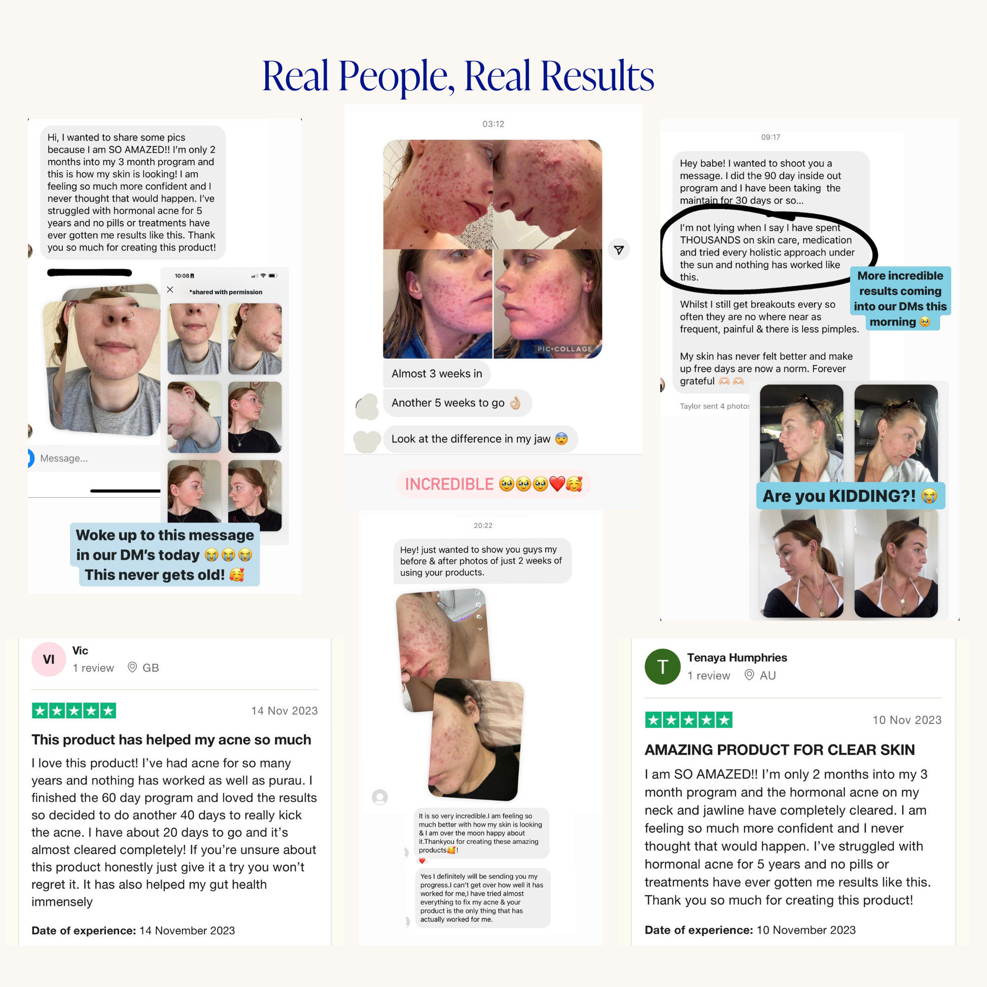 Advanced Acne Program™