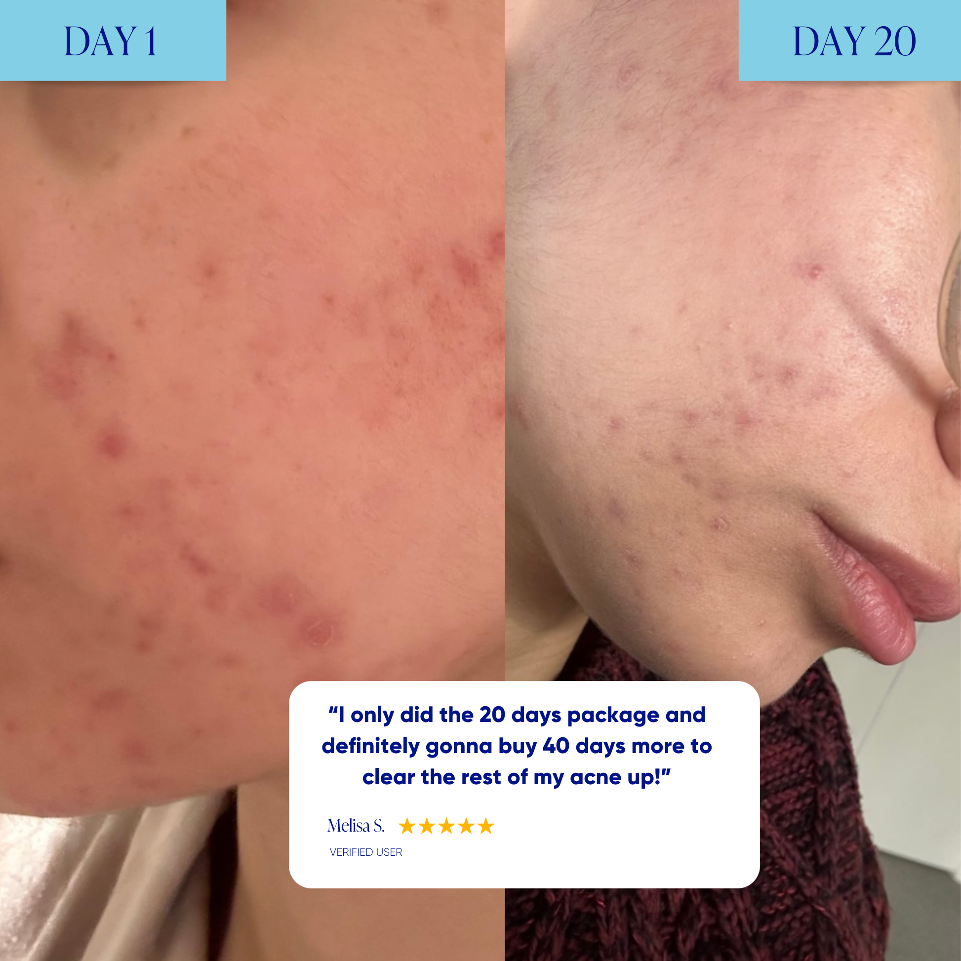 20-Day Inside & Out™