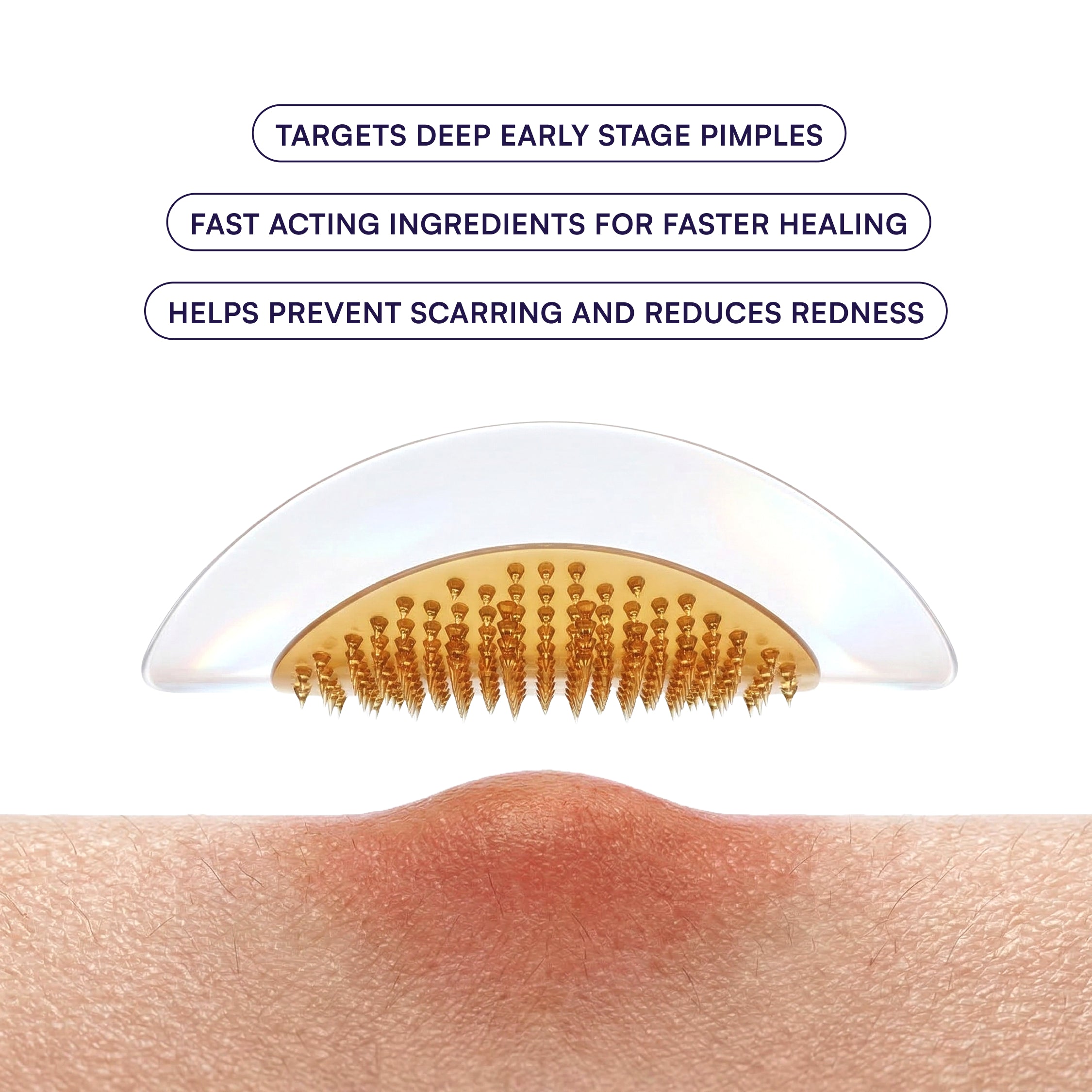 CICA Micro Darts - 9 Pack