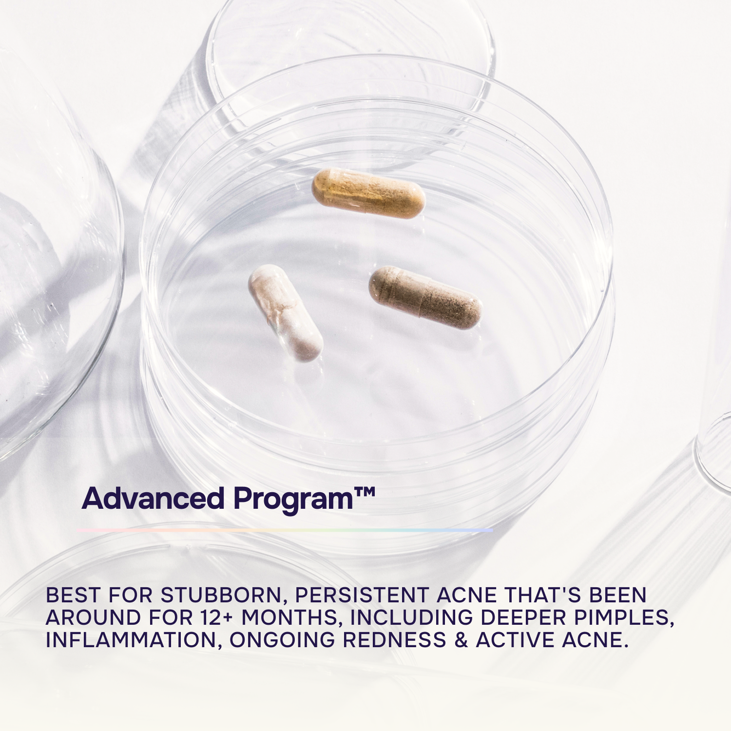 Advanced Acne Program™