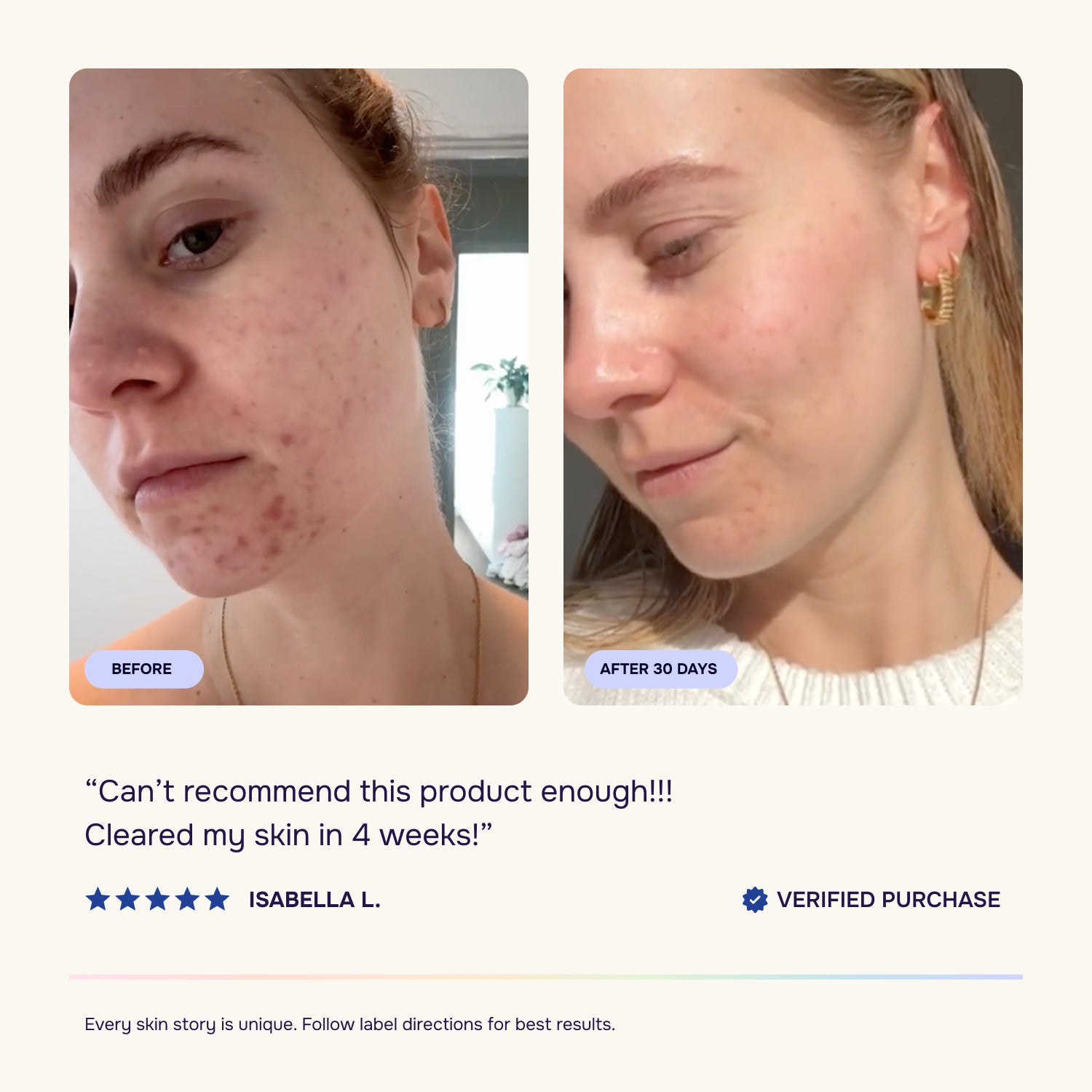 Starter Acne Program™