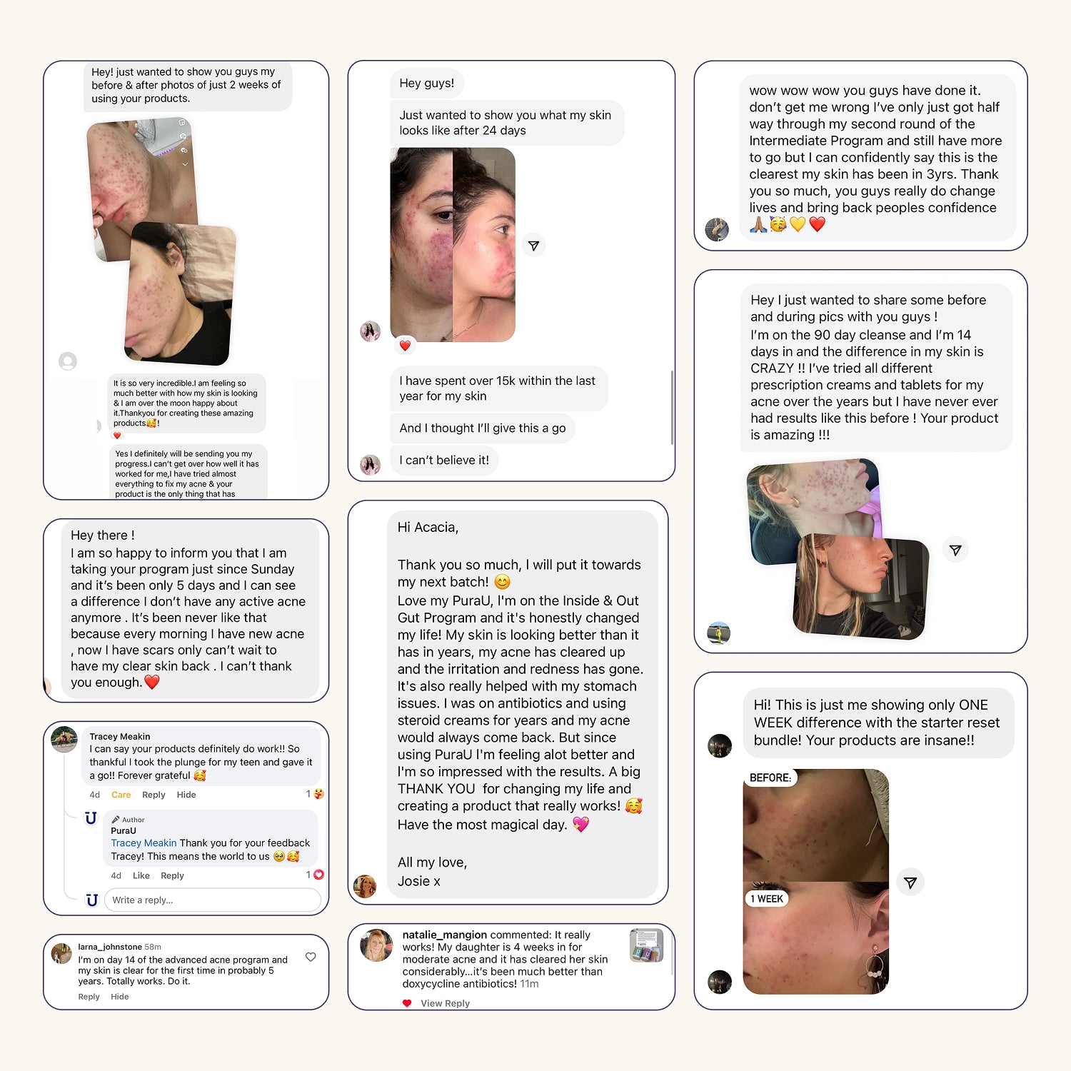 Starter Acne Program™