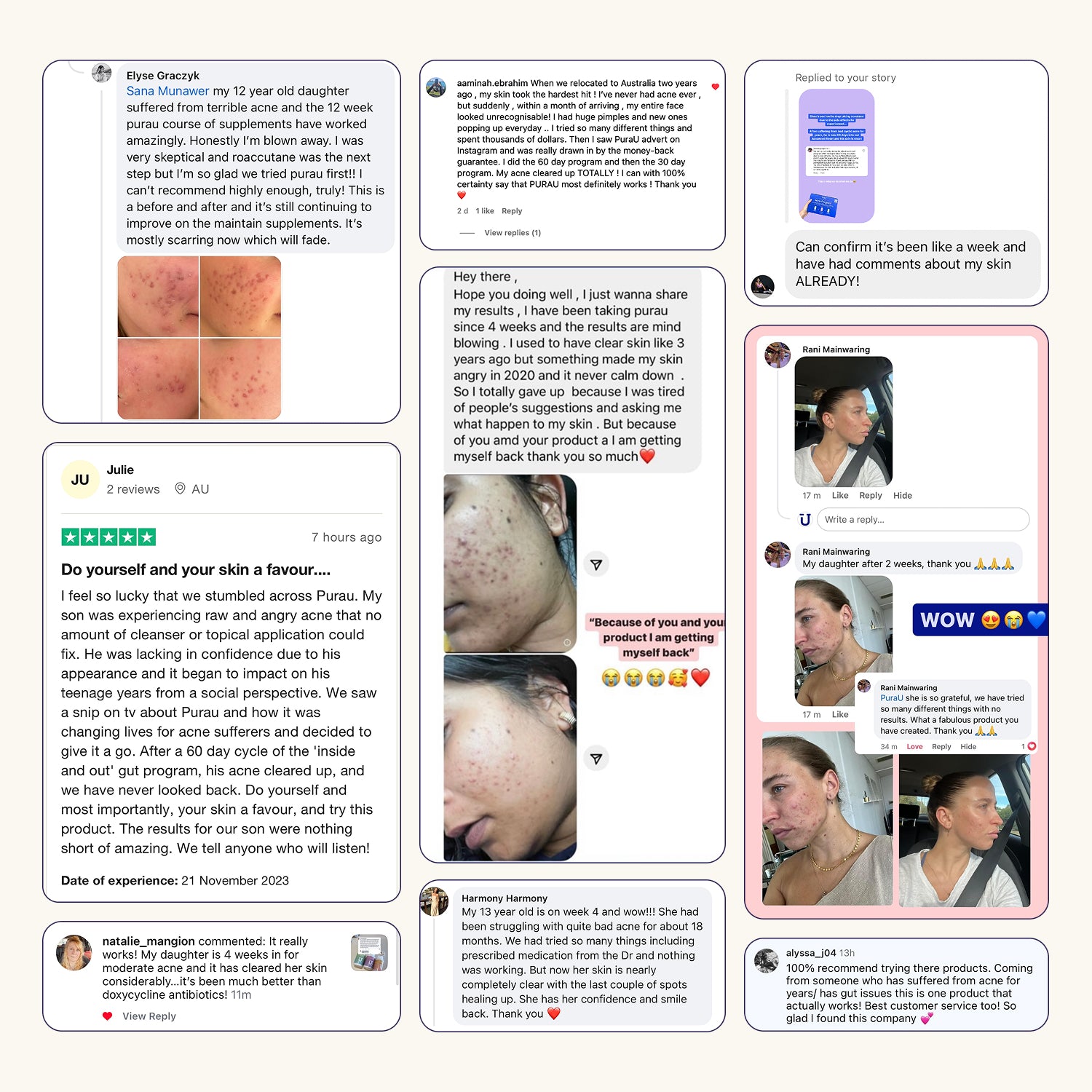 Starter Acne Program™