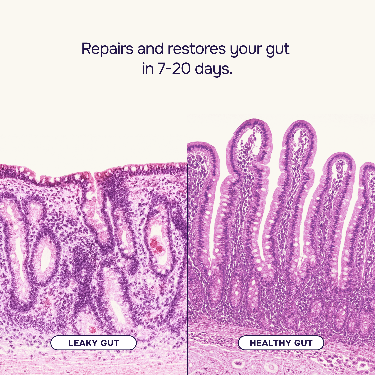Gut Repair Kit™